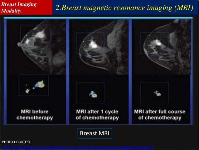 screening breast ultrasound Amatuer big black cock tube